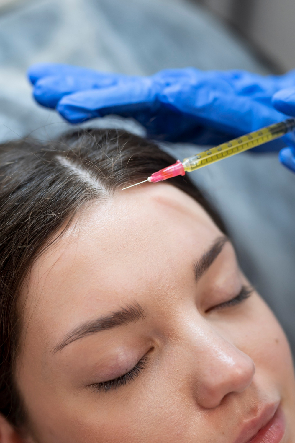 Hair restoration support and hair loss prevention